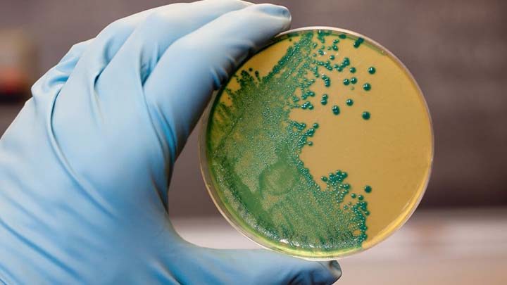 carne contaminata da listeria
