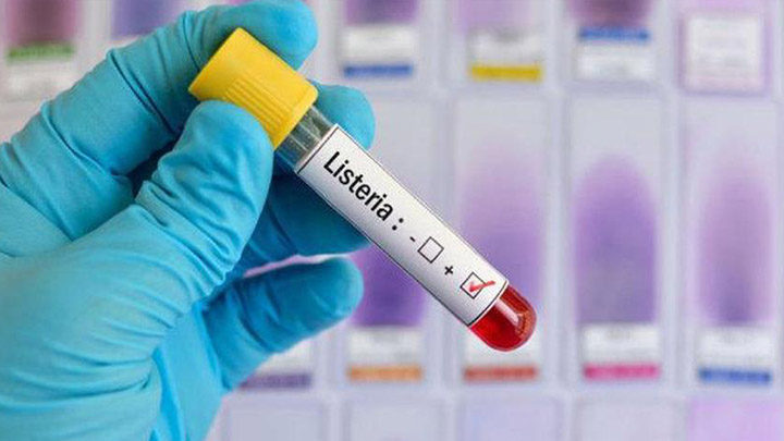 listeria terzo decesso