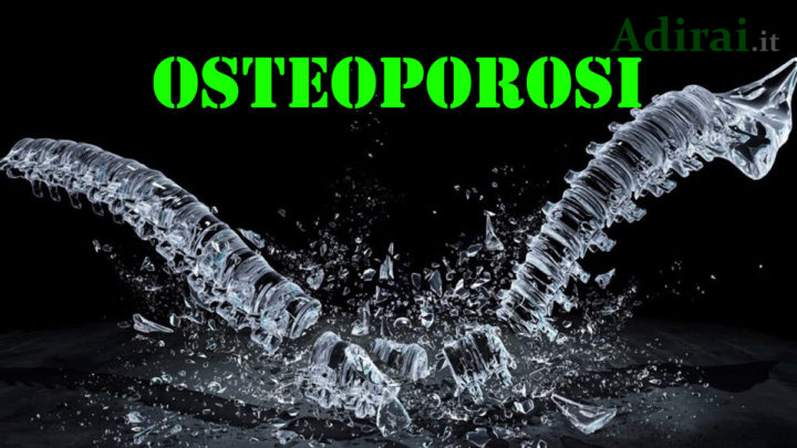 osteoporosi malattia delle ossa