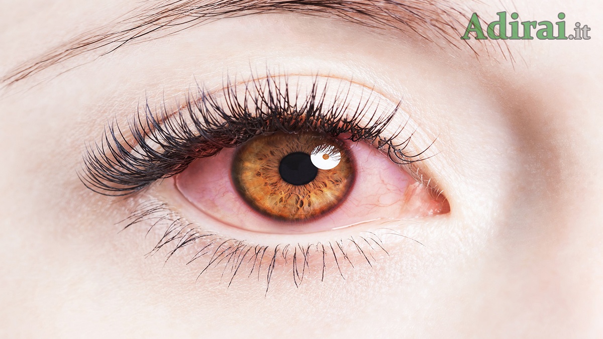 occhi rossi coronavirus nelle lacrime spallanzani